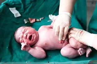 卫生部剖宫产教学视频,剖宫产手术操作流程与要点解析